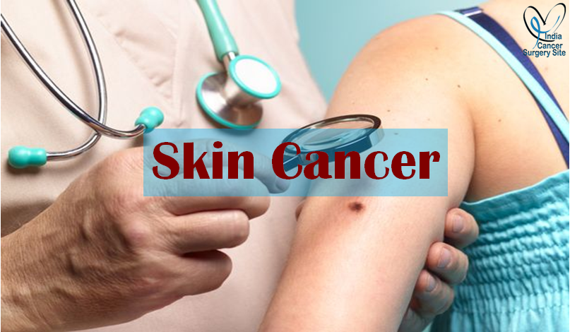 Skin Cancer Treatment Overview