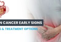 Illustration of colon cancer symptoms, stages, and treatments