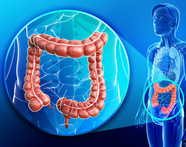 Advanced Colorectal Cancer Treatment India Hospitals For Colon