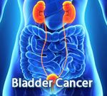 Bladder Cancer