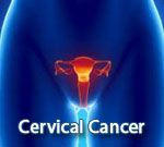 Cervical Cancer