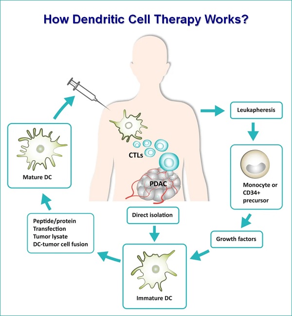 how dendritic cell therapy works
