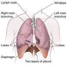 lung cancer