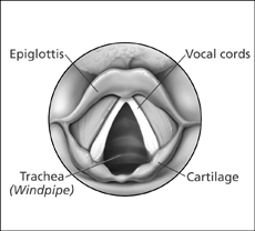 Illustration shows the epiglottis, trachea, and vocal cords