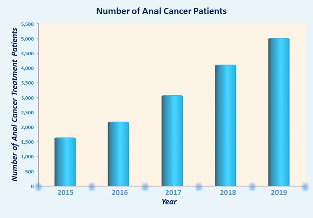 Low Cost Anal Cancer Treatment in India