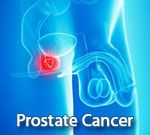 Prostate Cancer